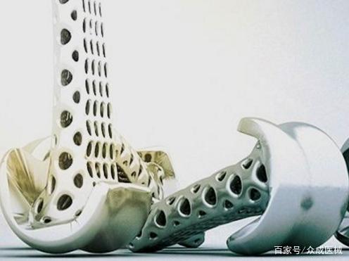 产品技术曲线助力医疗器械科技创新:医用镁合金在骨科植入的应用